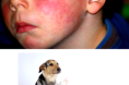 Аллергия на животных, собак, кошек у детей