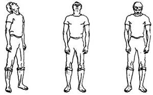 Упражнения при шейном-грудном (отделе позвоночника) остеохондрозе